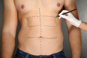 Six Pack Lipoaspiratia